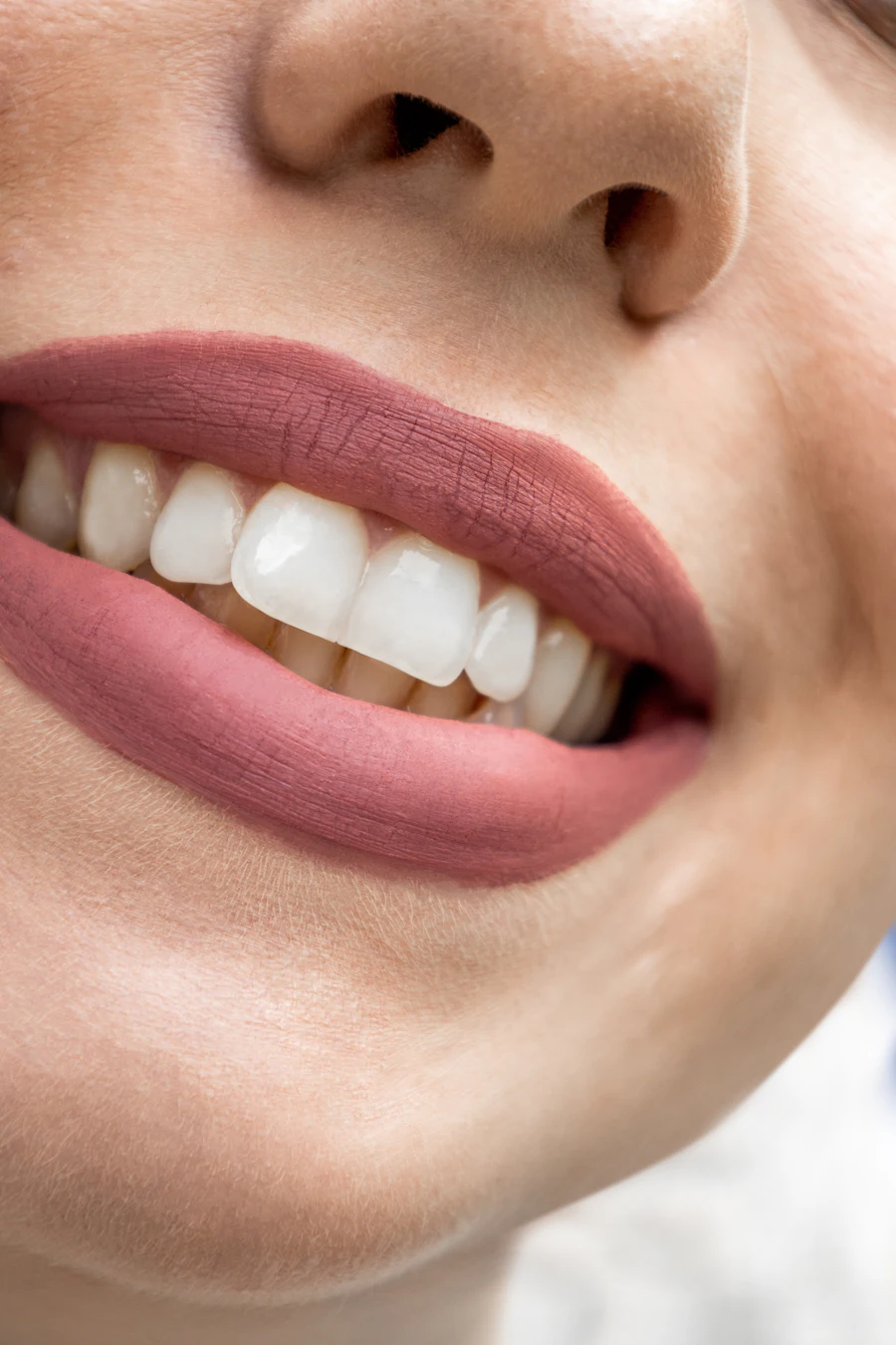 Close-up of a designed smile